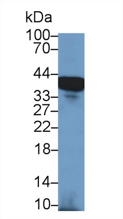 Polyclonal Antibody to Nucleophosmin 1 (NPM1)