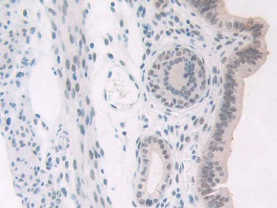 Polyclonal Antibody to Nucleophosmin 1 (NPM1)