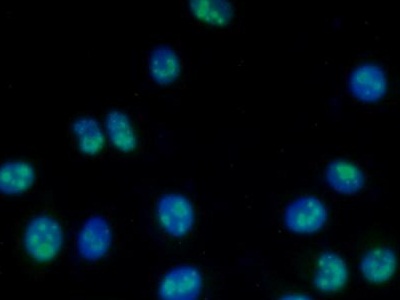 Polyclonal Antibody to Nucleophosmin 1 (NPM1)