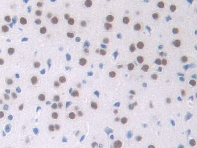 Polyclonal Antibody to Nucleophosmin 1 (NPM1)