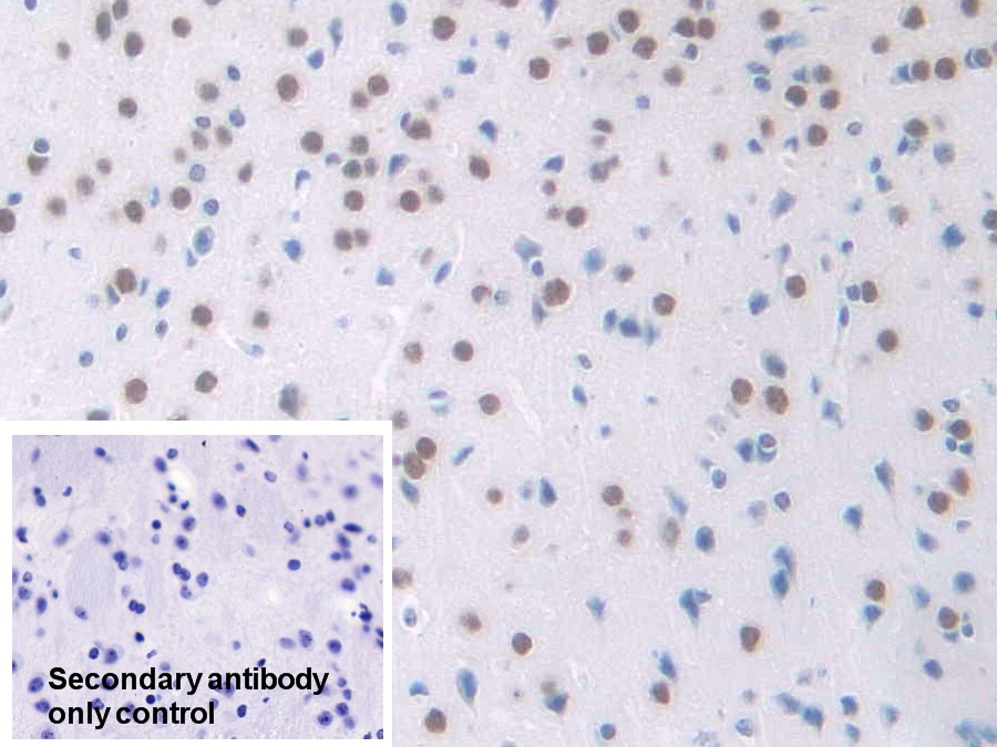 Polyclonal Antibody to Nucleophosmin 1 (NPM1)