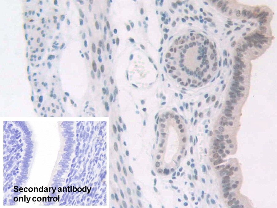 Polyclonal Antibody to Nucleophosmin 1 (NPM1)