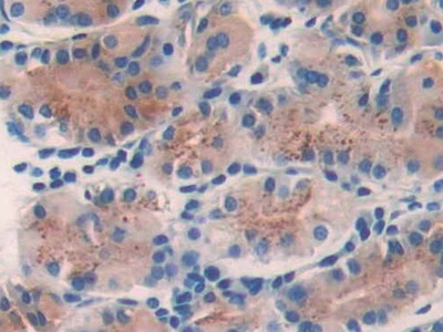 Polyclonal Antibody to Nicastrin (NCSTN)