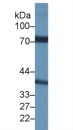 Polyclonal Antibody to Nicastrin (NCSTN)