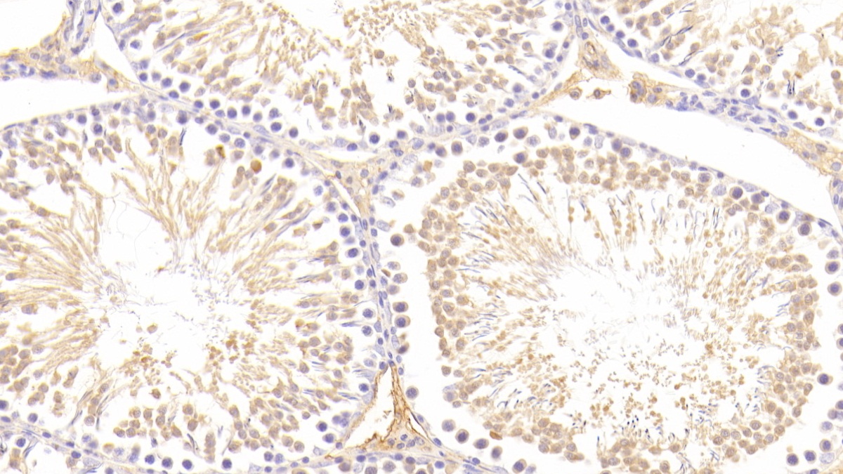 Polyclonal Antibody to Nicastrin (NCSTN)