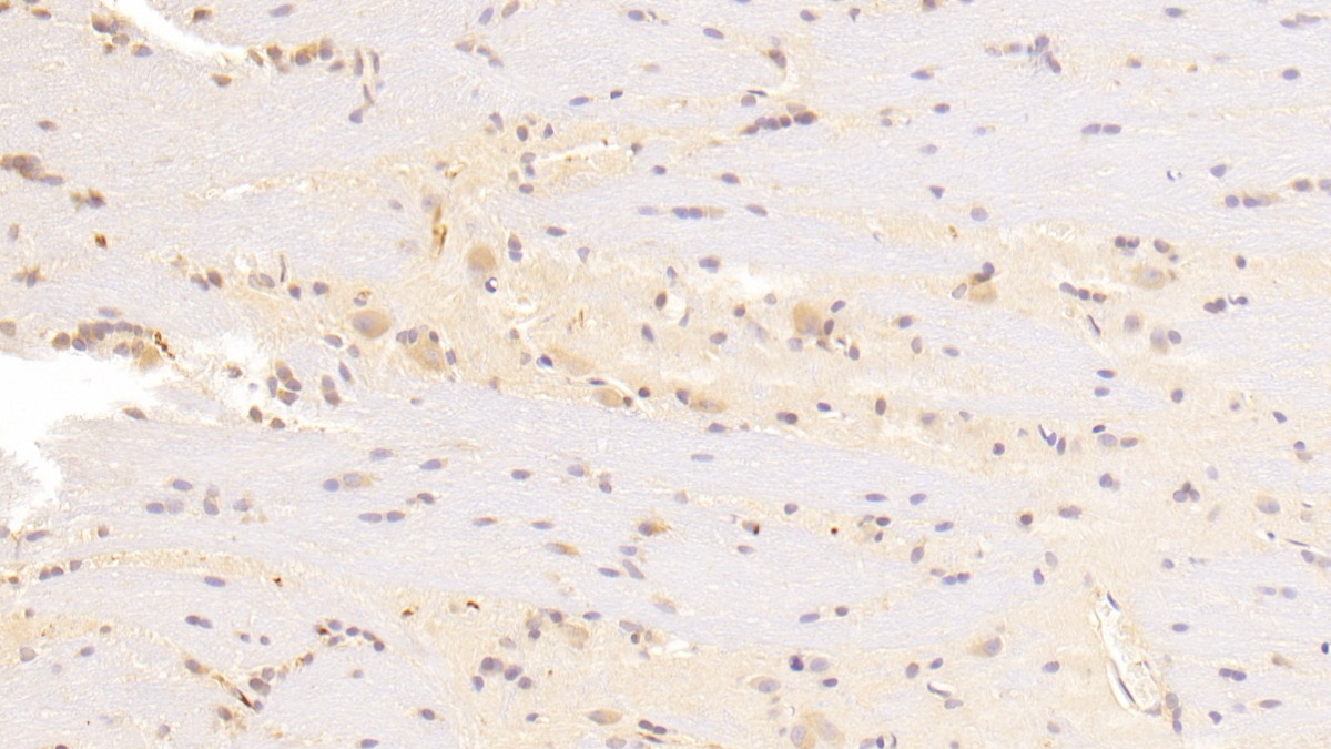 Polyclonal Antibody to Nicastrin (NCSTN)