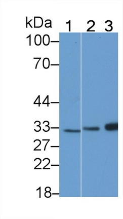 Polyclonal Antibody to Purine Nucleoside Phosphorylase (PNP)