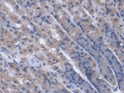 Polyclonal Antibody to Purine Nucleoside Phosphorylase (PNP)