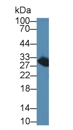 Polyclonal Antibody to Purine Nucleoside Phosphorylase (PNP)