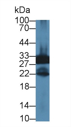 Polyclonal Antibody to Purine Nucleoside Phosphorylase (PNP)