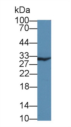 Polyclonal Antibody to Purine Nucleoside Phosphorylase (PNP)