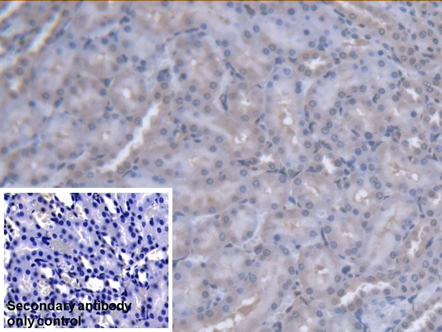 Polyclonal Antibody to Purine Nucleoside Phosphorylase (PNP)