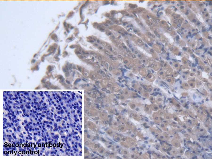 Polyclonal Antibody to Purine Nucleoside Phosphorylase (PNP)