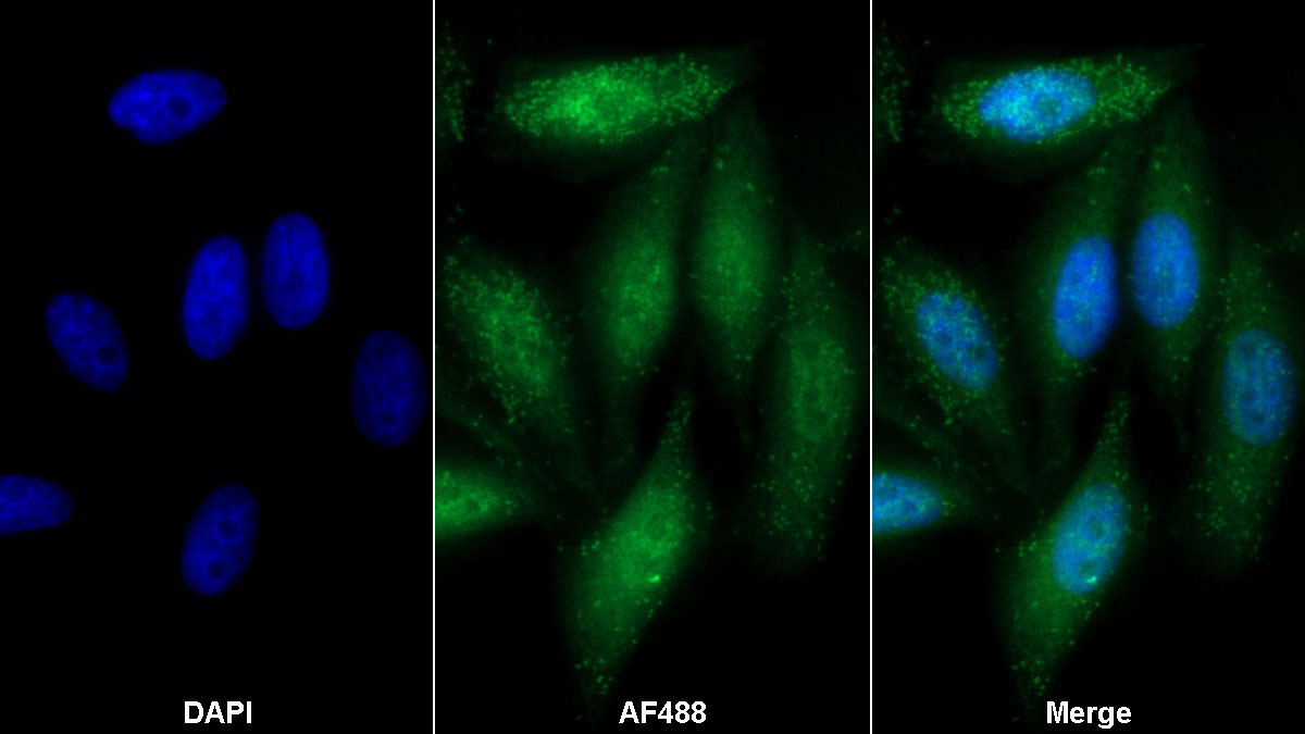 Polyclonal Antibody to 2',5'-Oligoadenylate Synthetase 1 (OAS1)