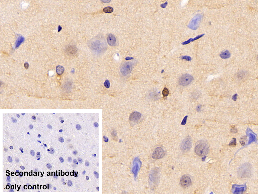 Polyclonal Antibody to Oligodendrocyte Lineage Transcription Factor 2 (OLIG2)