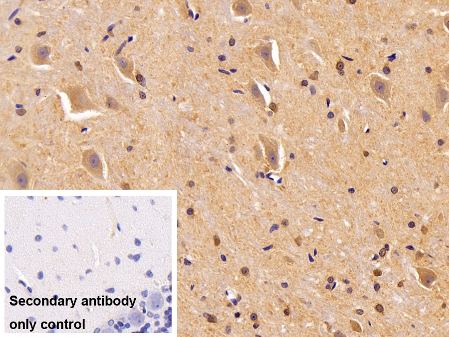 Polyclonal Antibody to Oligodendrocyte Lineage Transcription Factor 2 (OLIG2)