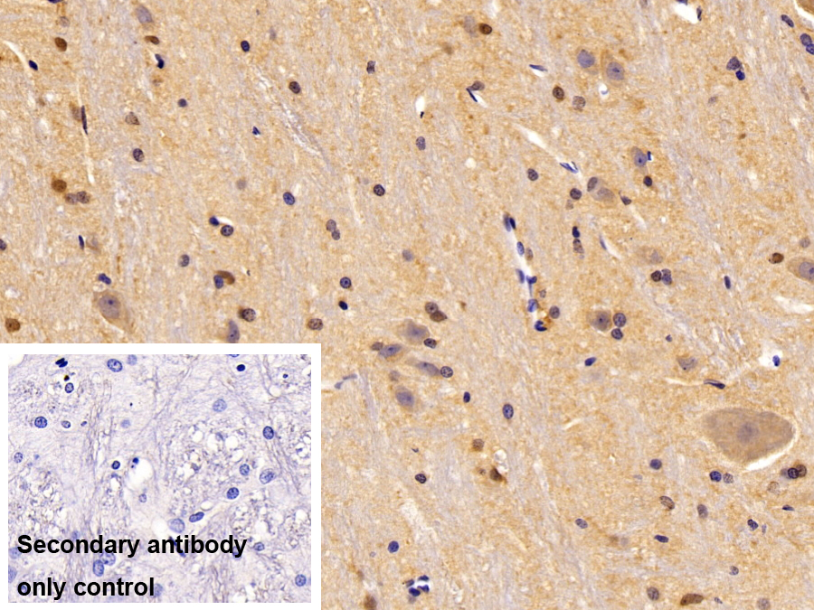 Polyclonal Antibody to Oligodendrocyte Lineage Transcription Factor 2 (OLIG2)