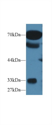 Polyclonal Antibody to Osteosarcoma Amplified 9 (OS9)