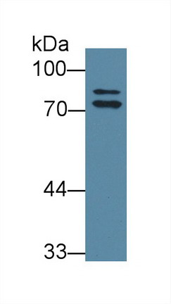 Polyclonal Antibody to Osteosarcoma Amplified 9 (OS9)