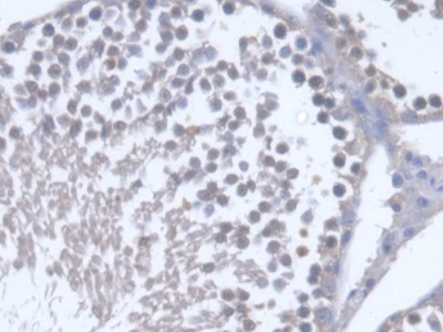 Polyclonal Antibody to Osteosarcoma Amplified 9 (OS9)