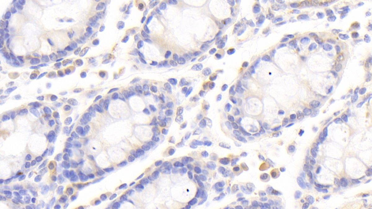 Polyclonal Antibody to Oxysterol Binding Protein (OSBP)