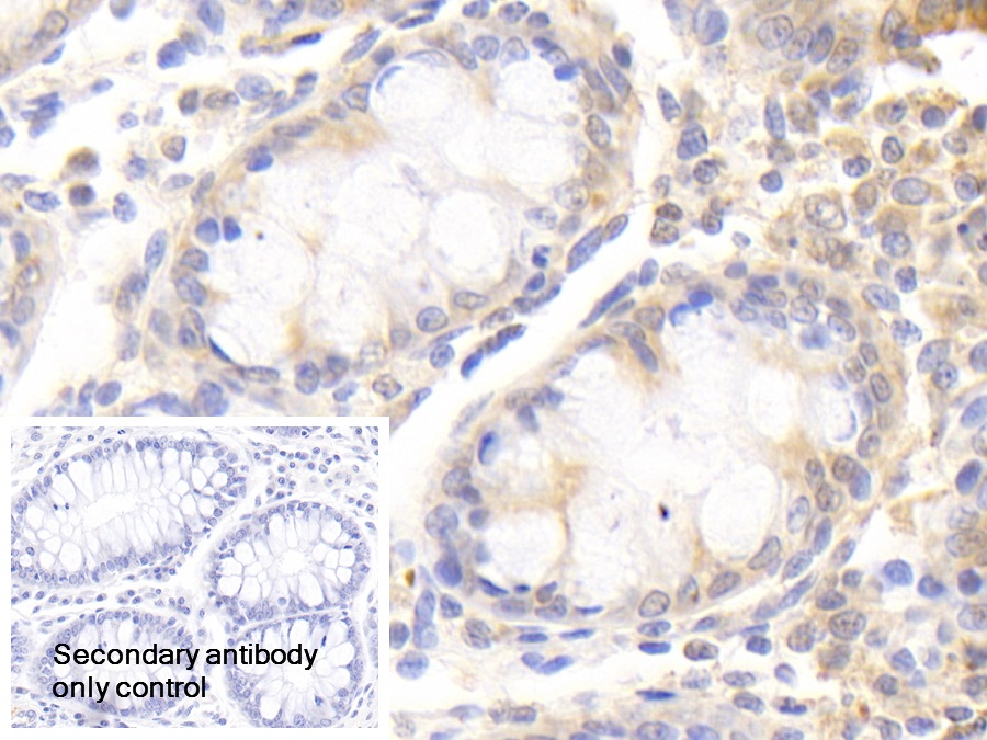 Polyclonal Antibody to Oxysterol Binding Protein (OSBP)