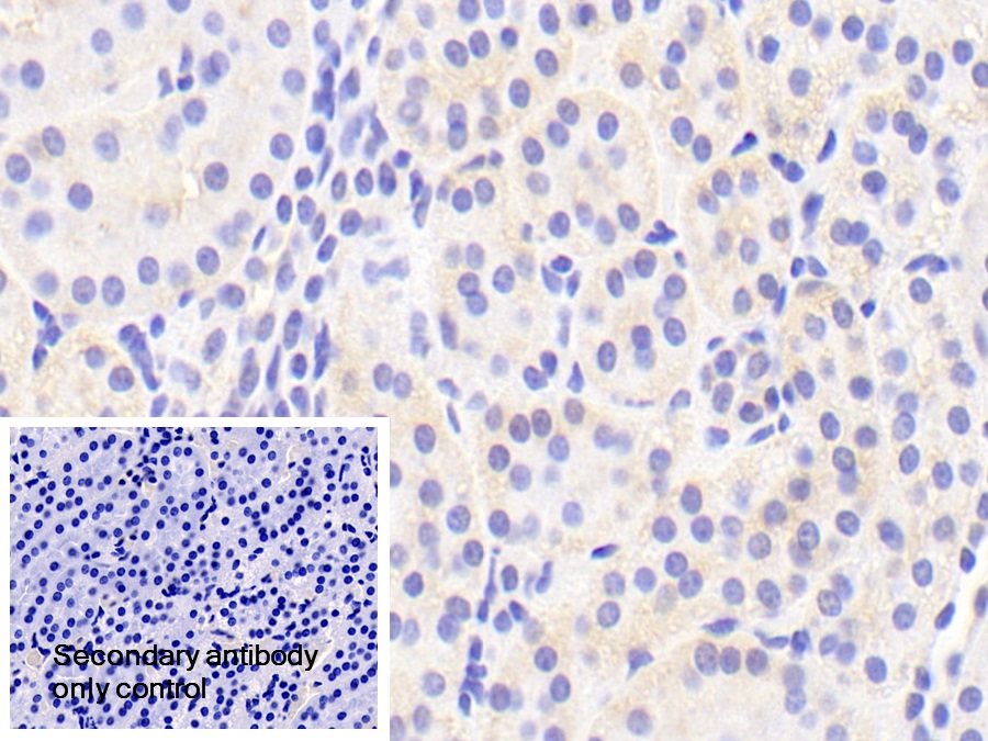 Polyclonal Antibody to Oxysterol Binding Protein (OSBP)