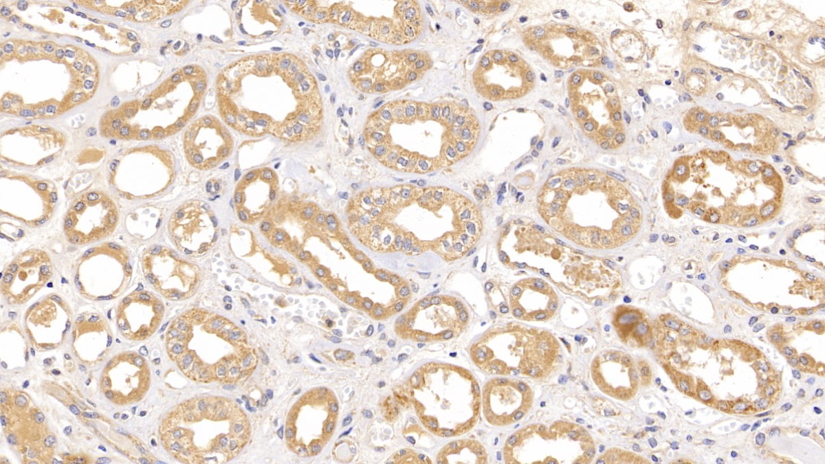 Polyclonal Antibody to Optic Atrophy 3 (OPA3)