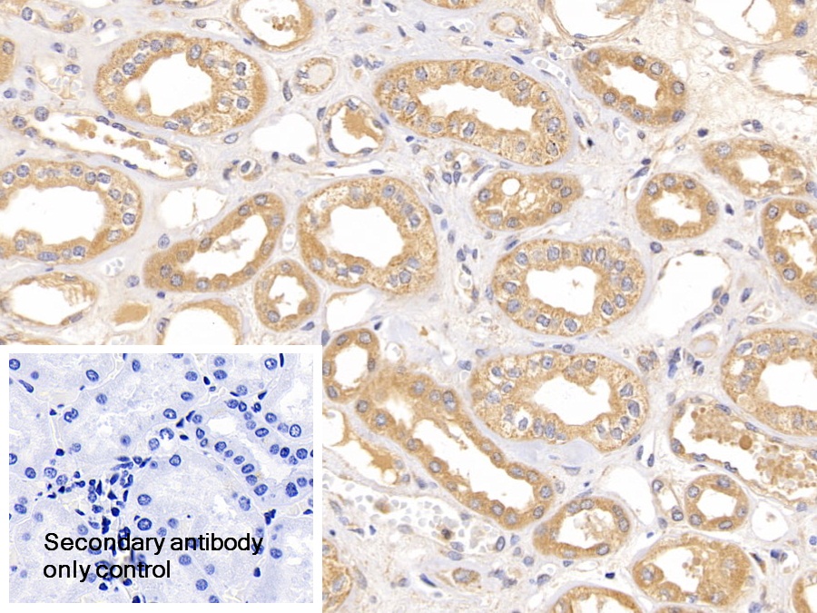 Polyclonal Antibody to Optic Atrophy 3 (OPA3)