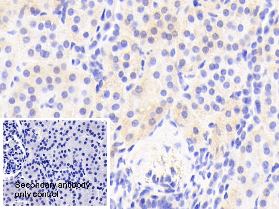 Polyclonal Antibody to Optic Atrophy 3 (OPA3)