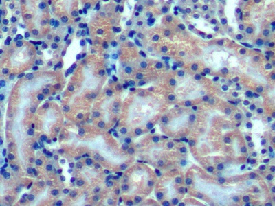 Polyclonal Antibody to Optic Atrophy 3 (OPA3)