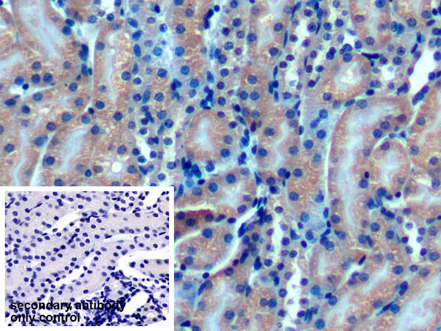 Polyclonal Antibody to Optic Atrophy 3 (OPA3)