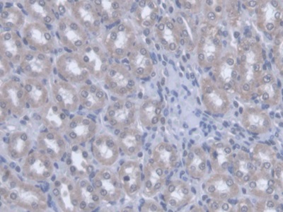 Polyclonal Antibody to Optic Atrophy 3 (OPA3)