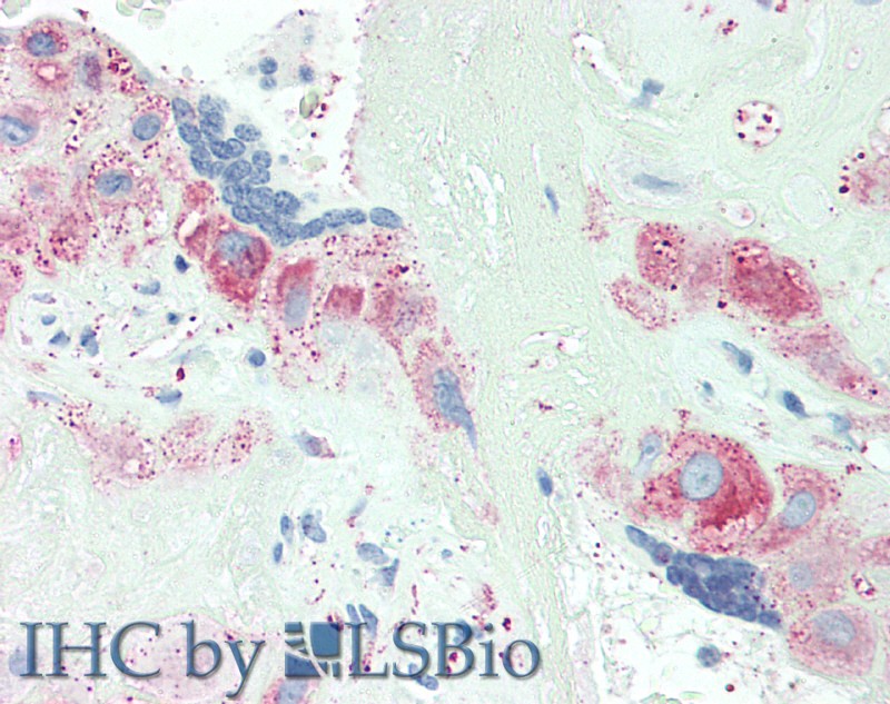 Polyclonal Antibody to Anoctamin 2 (ANO2)