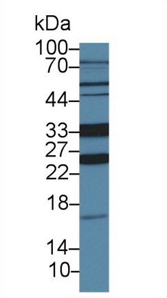 Polyclonal Antibody to Oxoguanine Glycosylase 1 (OGG1)