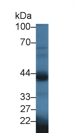 Polyclonal Antibody to Oxytocin Receptor (OXTR)