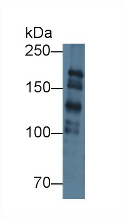 Polyclonal Antibody to Polymerase DNA Directed Alpha 1 (POLa1)