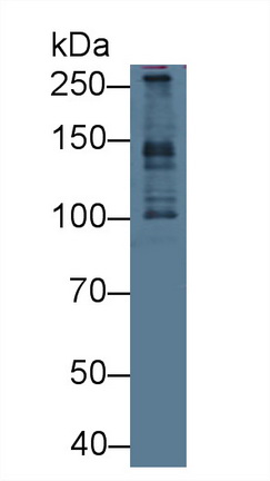 Polyclonal Antibody to Pericentriolar Material 1 (PCM1)