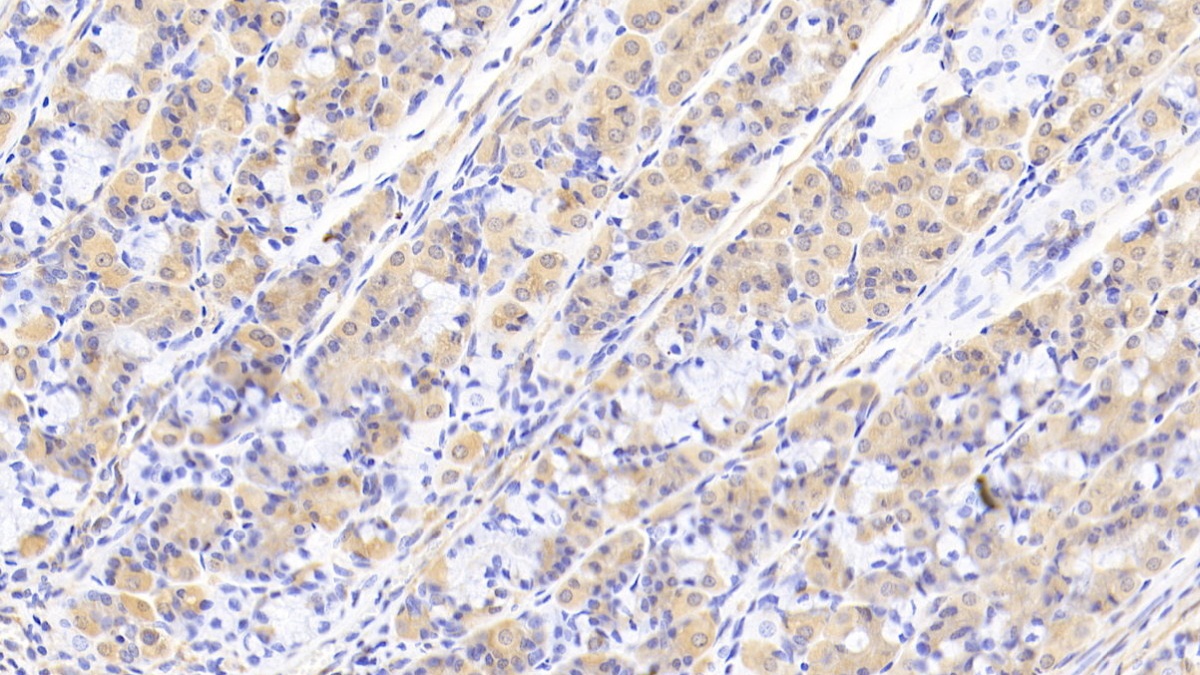 Polyclonal Antibody to Peroxisomal Biogenesis Factor 1 (PEX1)