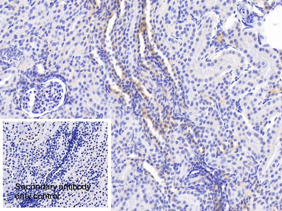 Polyclonal Antibody to Peroxisomal Biogenesis Factor 1 (PEX1)