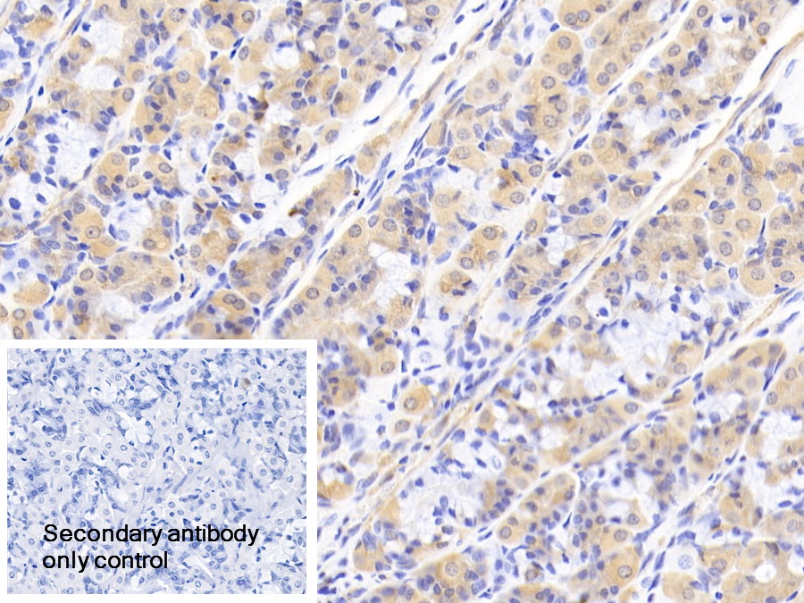 Polyclonal Antibody to Peroxisomal Biogenesis Factor 1 (PEX1)