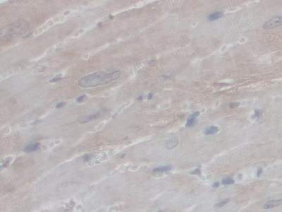 Polyclonal Antibody to Peroxisomal Biogenesis Factor 1 (PEX1)