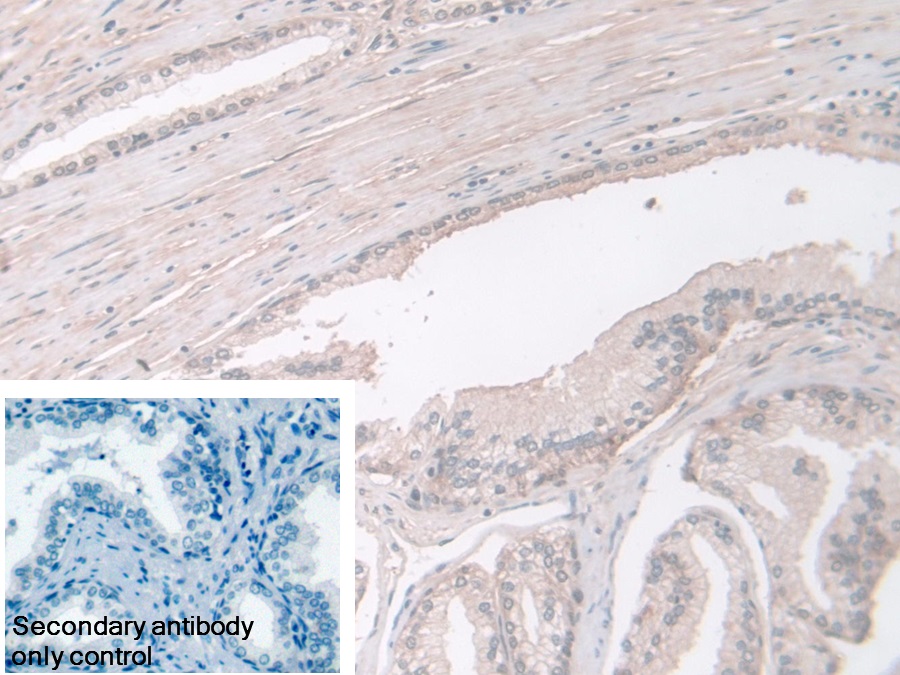 Polyclonal Antibody to Phosphoglucomutase 1 (PGM1)