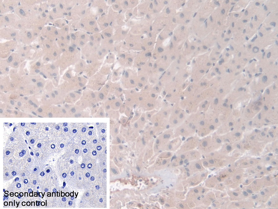 Polyclonal Antibody to Phosphoglucomutase 1 (PGM1)