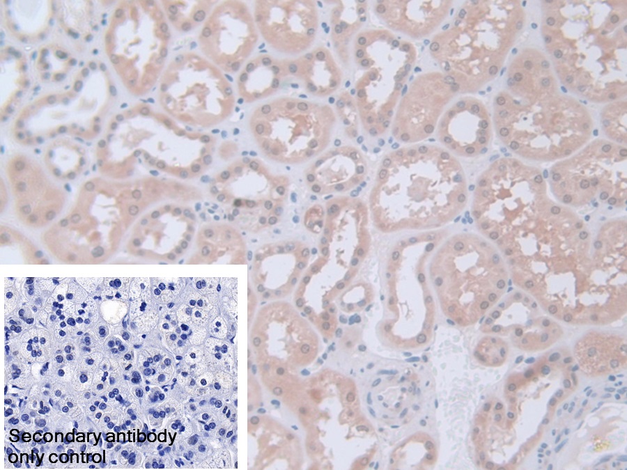 Polyclonal Antibody to Phosphoglucomutase 1 (PGM1)