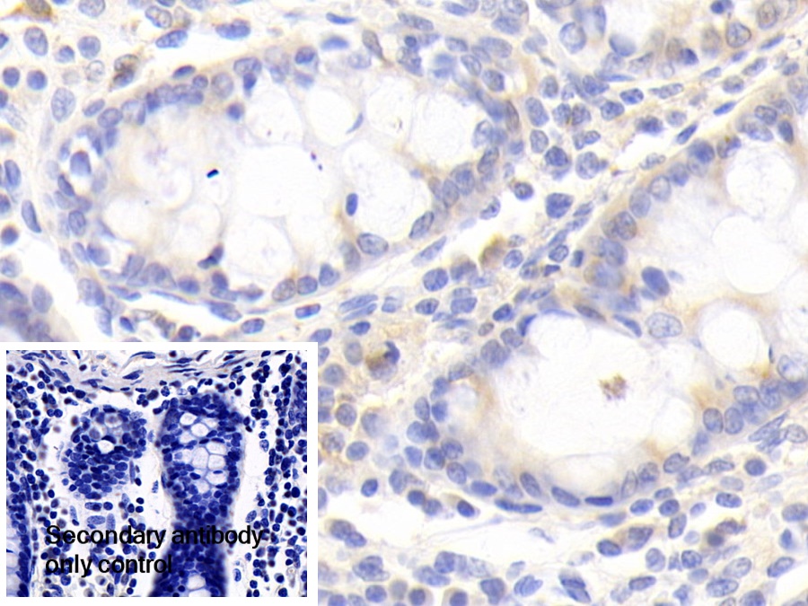 Polyclonal Antibody to Pyridoxamine-5'-Phosphate Oxidase (PNPO)