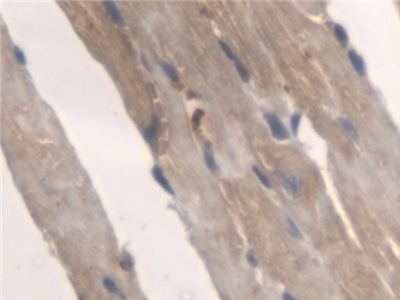 Polyclonal Antibody to Pyridoxamine-5'-Phosphate Oxidase (PNPO)