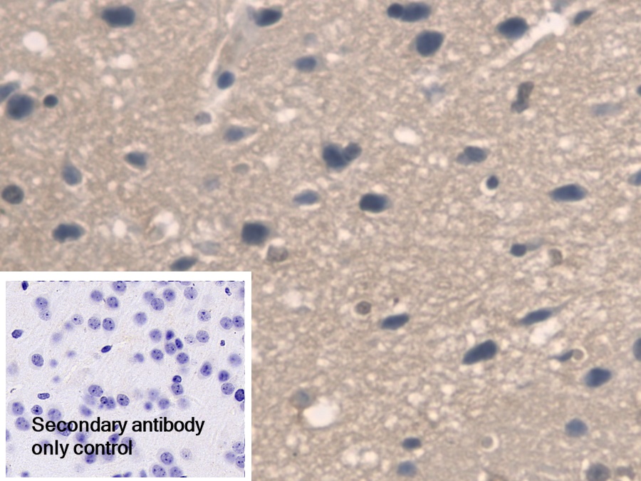 Polyclonal Antibody to Pyridoxamine-5'-Phosphate Oxidase (PNPO)