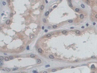 Polyclonal Antibody to Protein O-Mannosyltransferase 1 (POMT1)