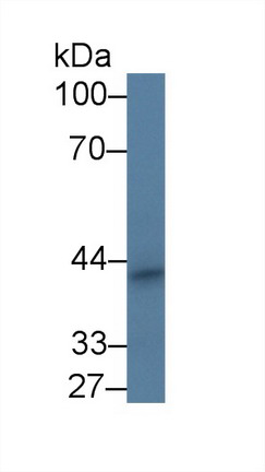 Polyclonal Antibody to Periphilin 1 (PPHLN1)